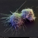 201107-014a Lymphoblast Cells